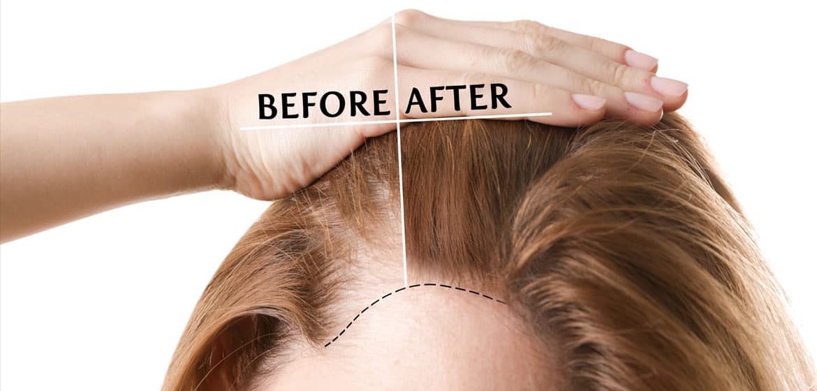 کوکتل تقویت مو توسکانی جدید Toskani Hair 2021 - Image 6
